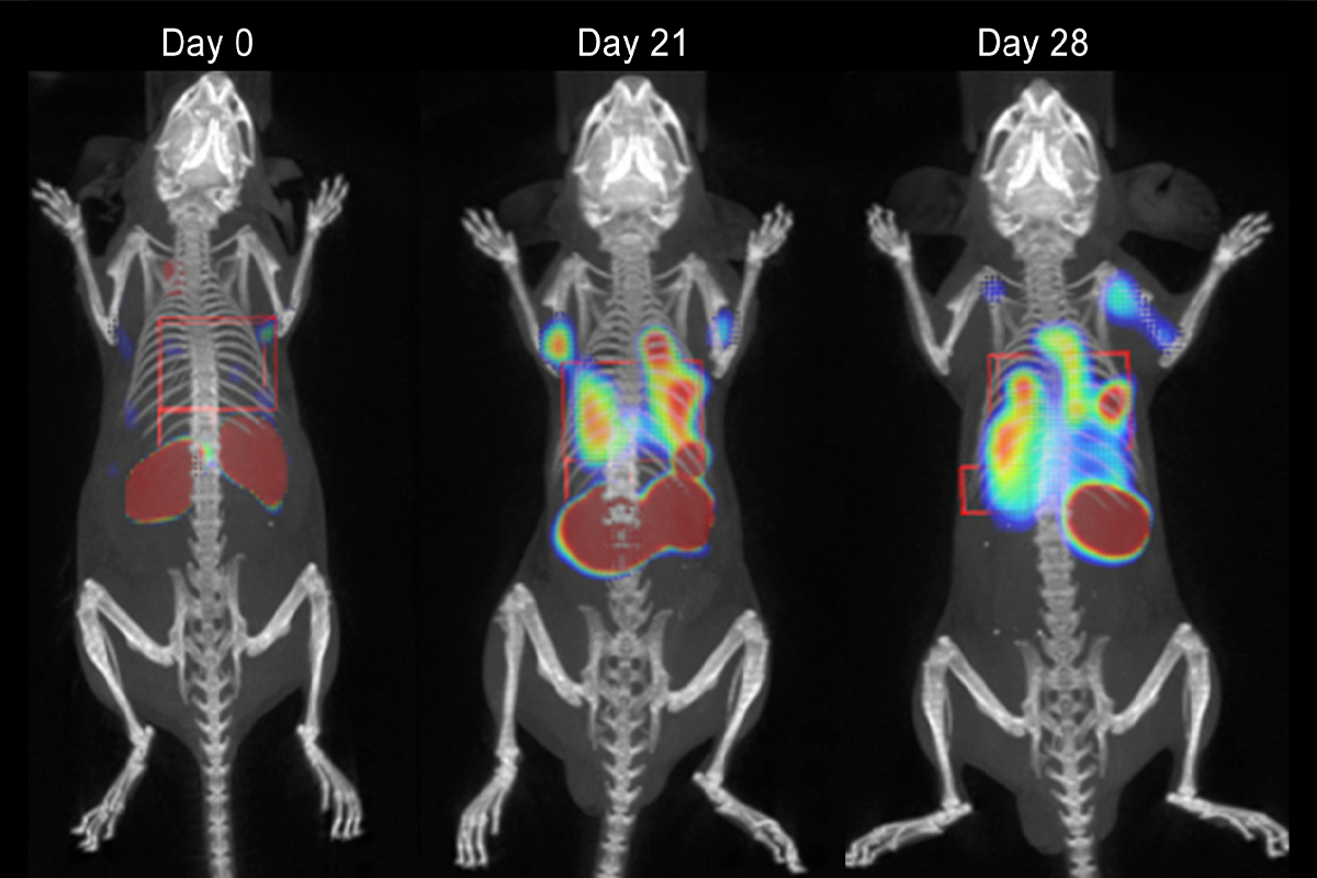 Disease_Progression copy