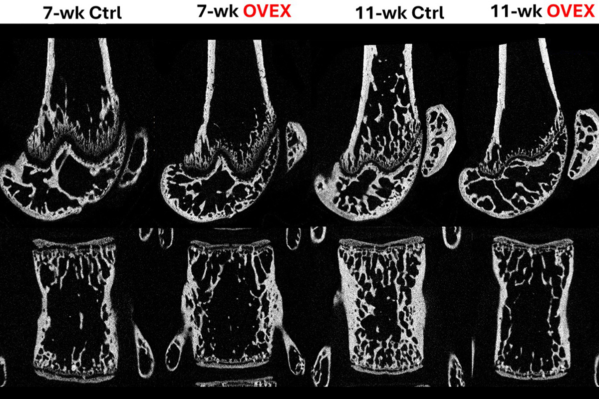 OVEX vs control femur and spine copy