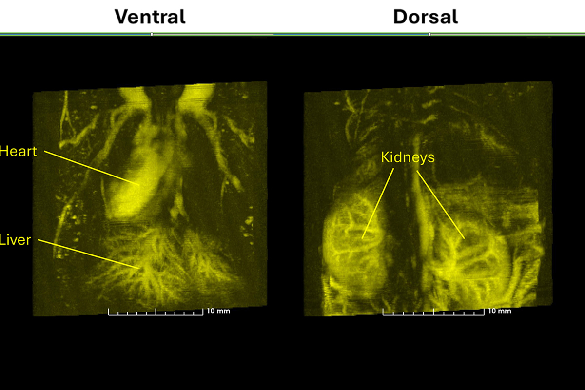 Vega VesselVue heart kidneys liver copy